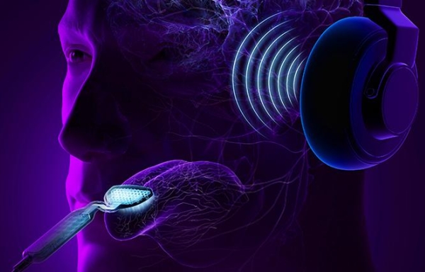efficacité Acouphènes : l’association de sons et de stimulations électriques sur la langue montre son efficacité